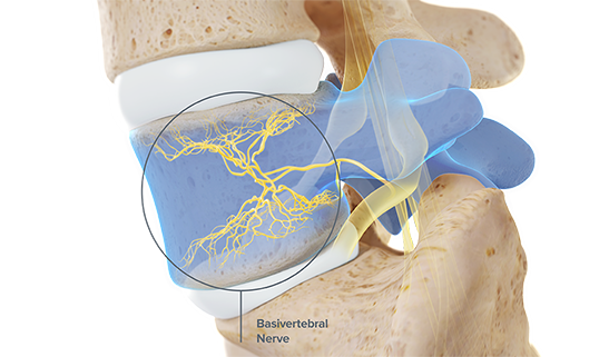 basivertebral nerve