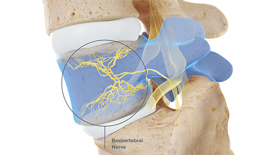 Basivertebral nerve basivertebral nerve